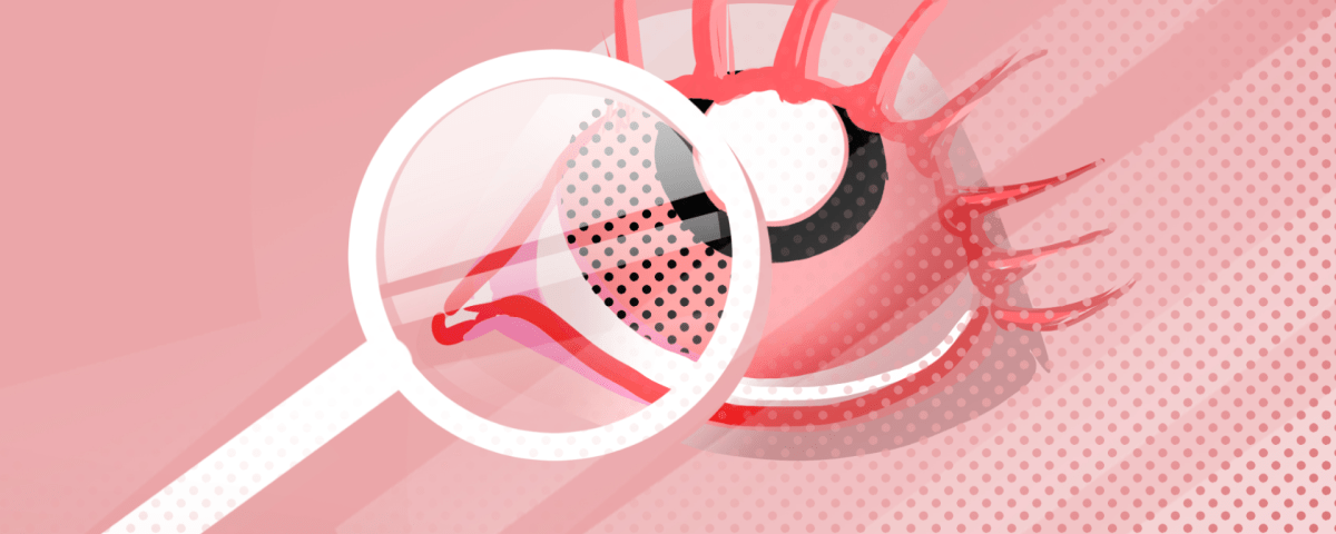 Looking at Retinoblastoma Through the Lens of Global Health