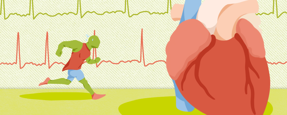 Don’t Sweat It: Debunking the Alleged Consequences of Exercise on Heart Health